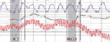 Brea polygraph